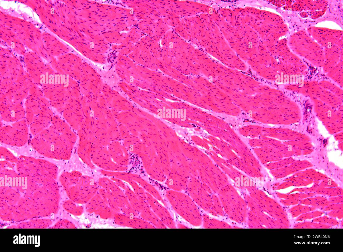 Quergestreifte oder Skelettmuskulatur mit konnetivem Gewebe. X 75 bei 10 cm Breite. Stockfoto