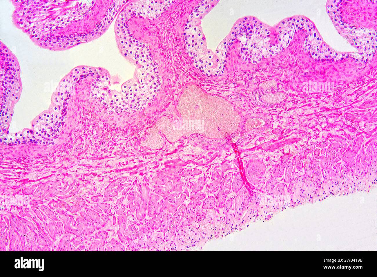 Harnblase mit Urothel (Übergangsepithel), Bindegewebe und glatten Muskelfasern. Photomikrograph X75 mit einer Breite von 10 cm. Stockfoto