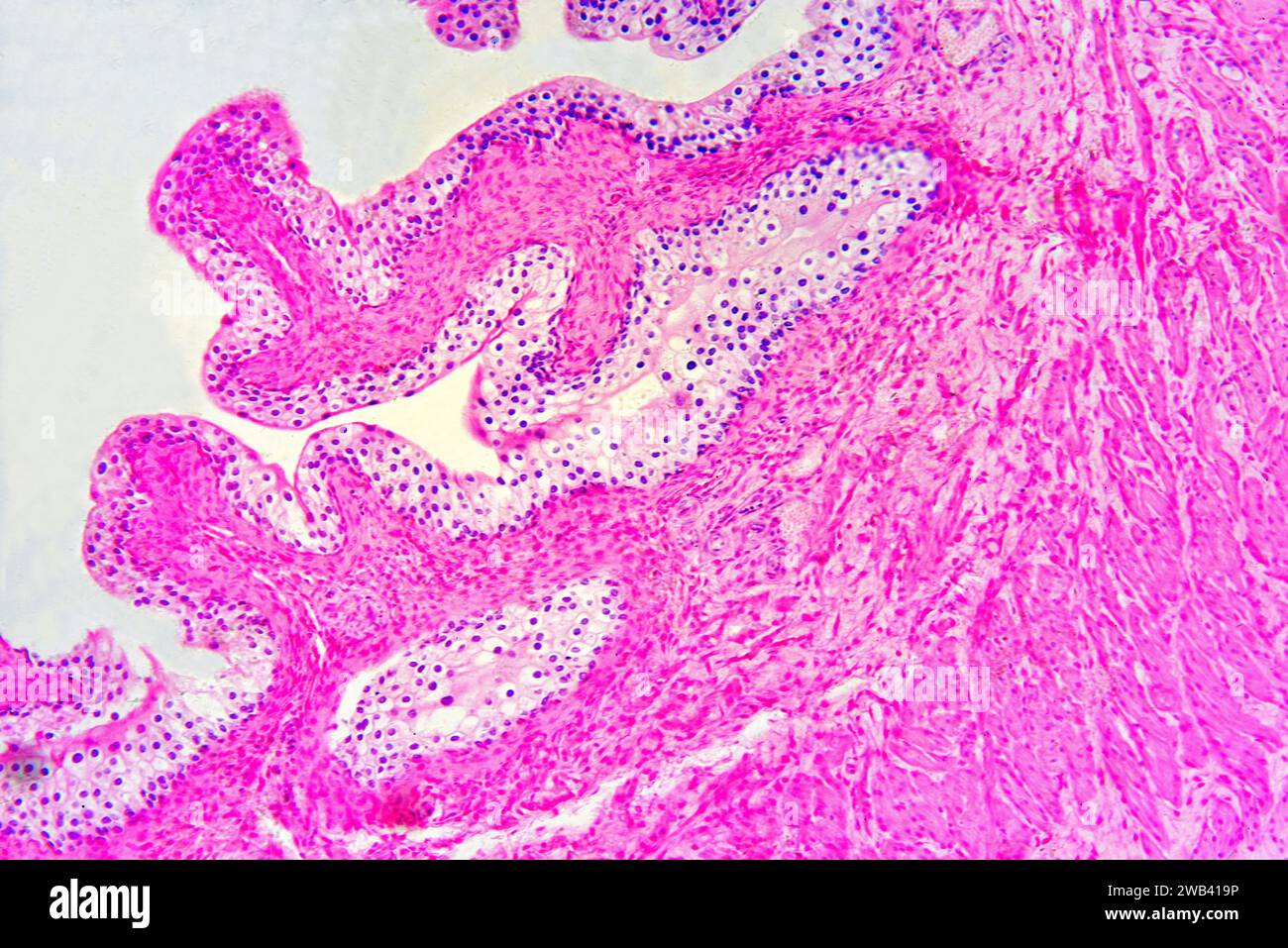 Harnblase mit Urothel (Übergangsepithel), Bindegewebe und glatten Muskelfasern. Photomikrograph X75 mit einer Breite von 10 cm. Stockfoto