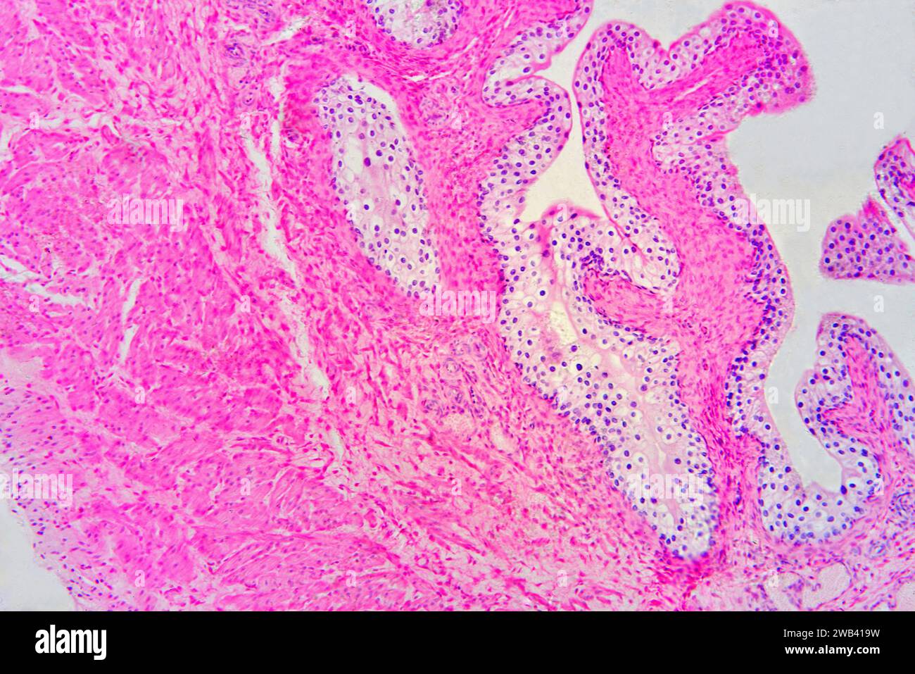 Harnblase mit Urothel (Übergangsepithel), Bindegewebe und glatten Muskelfasern. Photomikrograph X75 mit einer Breite von 10 cm. Stockfoto