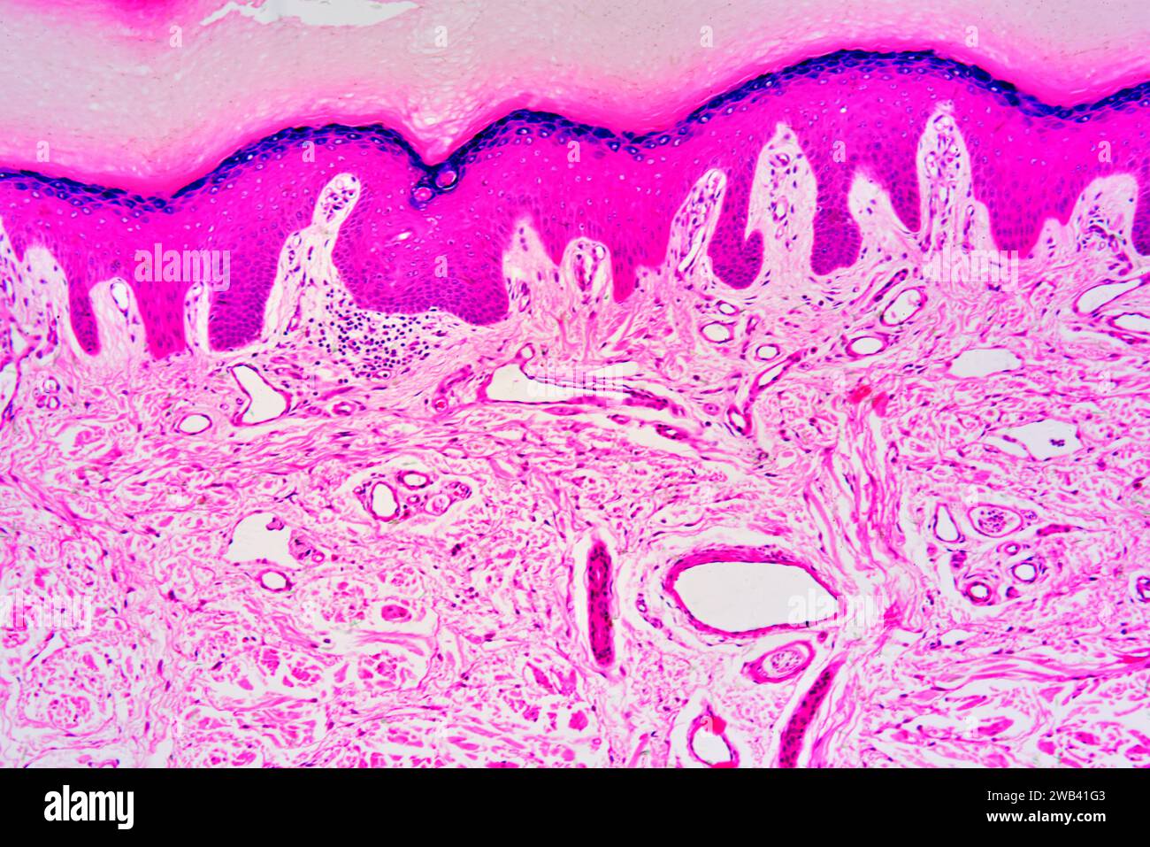 Menschliche Haut mit Epidermis und Dermis mit Schweißdrüse. Photomikrograph X75 mit einer Breite von 10 cm. Stockfoto