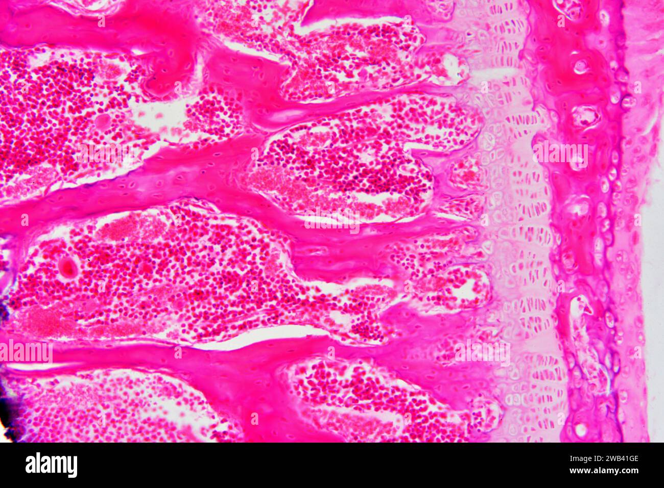 Rotes Knochenmark (Knochenmark), ein hämatopietisches Organ. Photomikrograph X150 mit einer Breite von 10 cm. Stockfoto