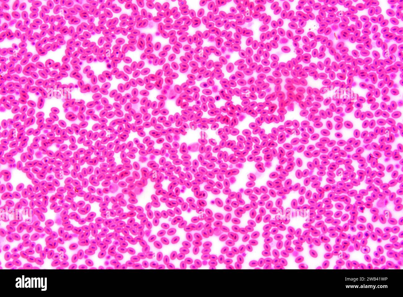 Schlangenblut. Rote Blutkörperchen mit Nukleonen. Photomikrograph X150 mit einer Breite von 10 cm. Stockfoto