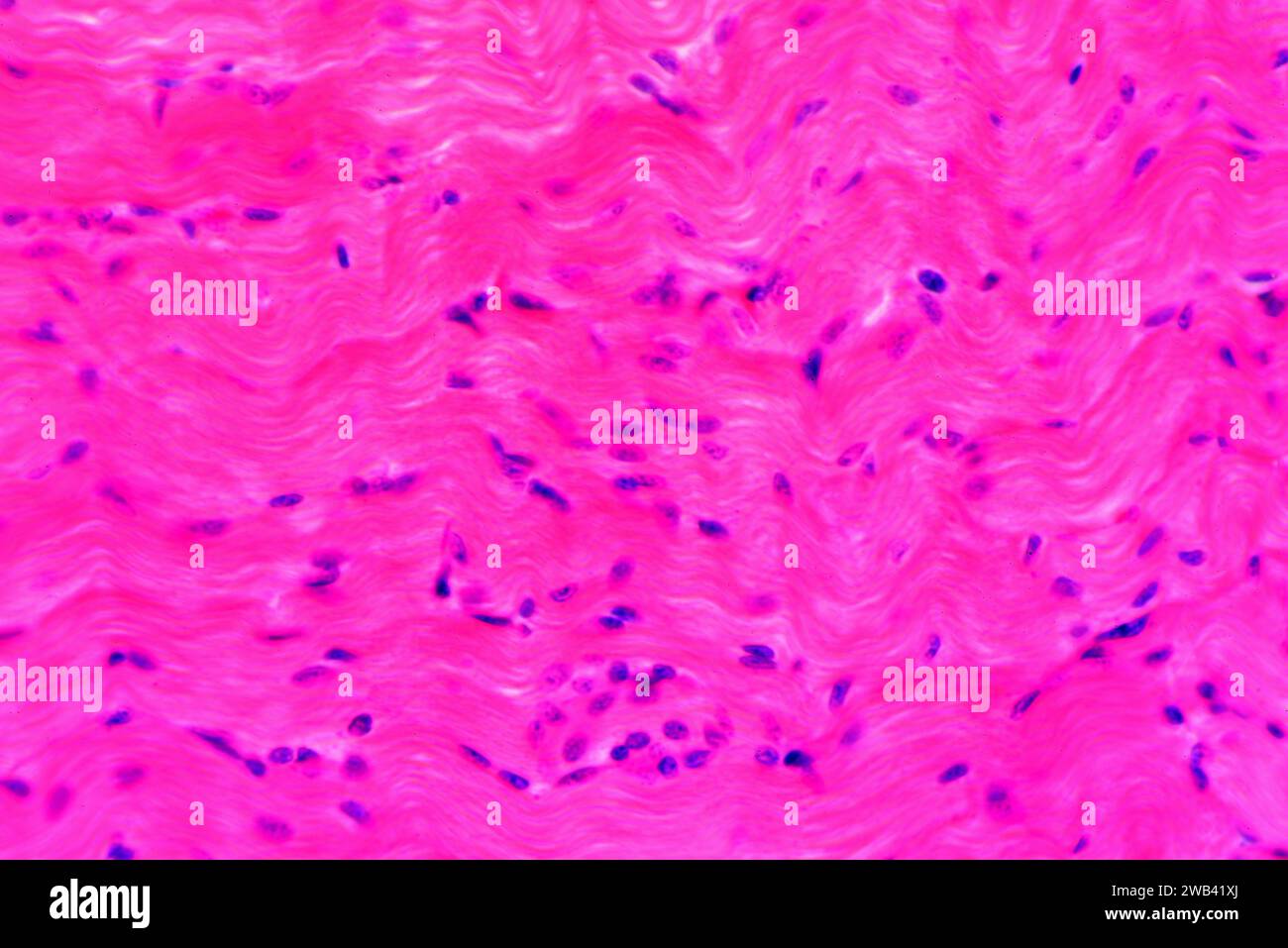 Glatte Muskulatur Längsschnitt. Photomikrograph X300 mit einer Breite von 10 cm. Stockfoto