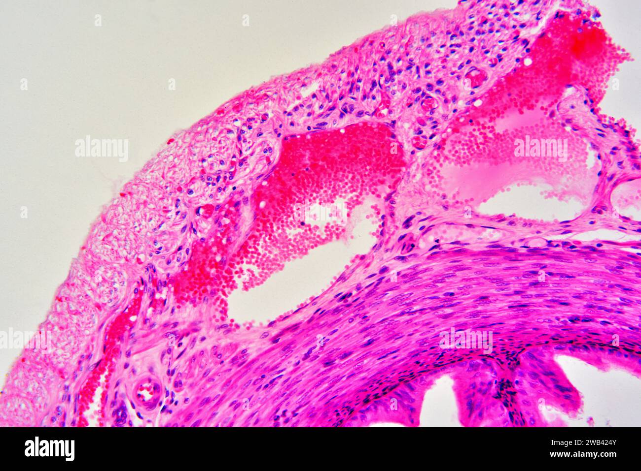 Venen mit roten Blutkörperchen umgeben von Bindegewebe und glatten Muskelfasern. Photomikrograph X150 mit einer Breite von 10 cm. Stockfoto