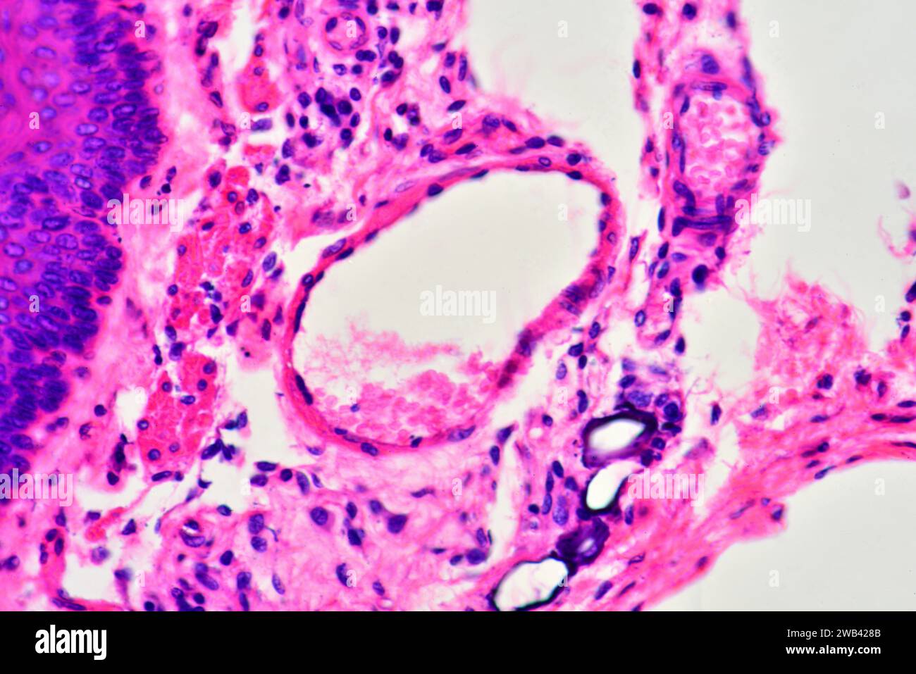 Vene umgeben von Bindegewebe und Epithel (links). Photomikrograph X300 mit einer Breite von 10 cm. Stockfoto