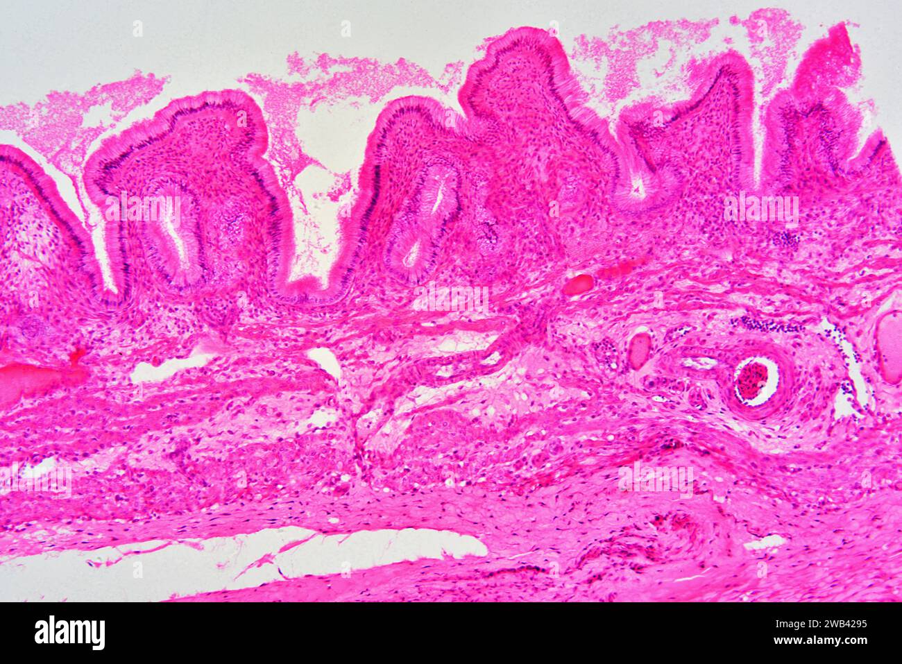 Gallenblasenwand mit säulenarem Epithel mit Schleimhautfoldsi, Bindegewebe und glatten Muskelfasern. Photomikrograph X30 mit einer Breite von 10 cm. Stockfoto