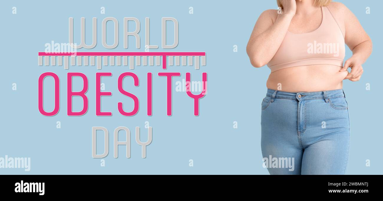 Übergewichtige Frau auf hellblauem Hintergrund. Welttag Der Adipositas Stockfoto