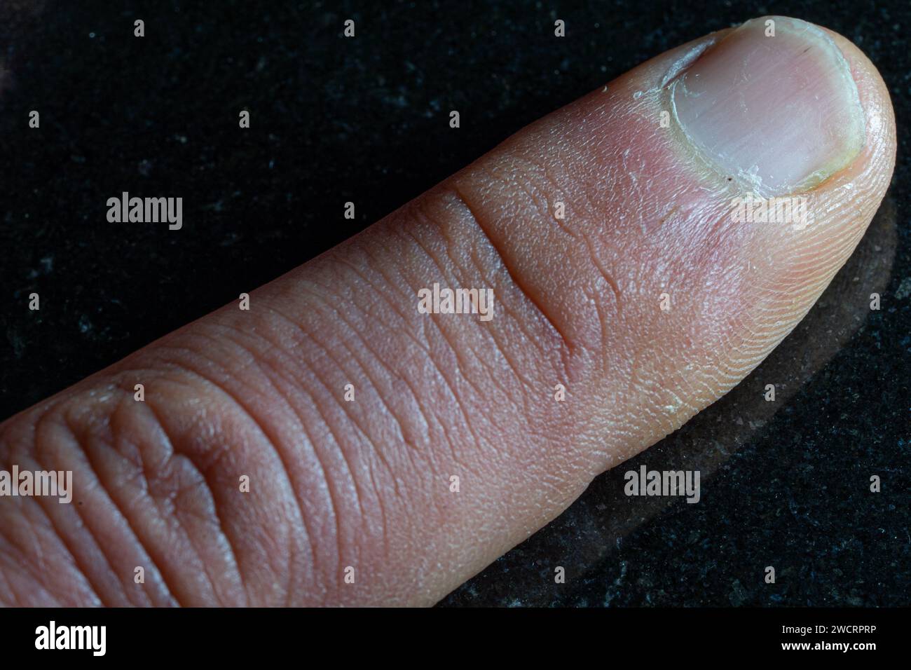 Menschlicher Zeigefinger unter glattem schwarzem Steinhintergrund Stockfoto