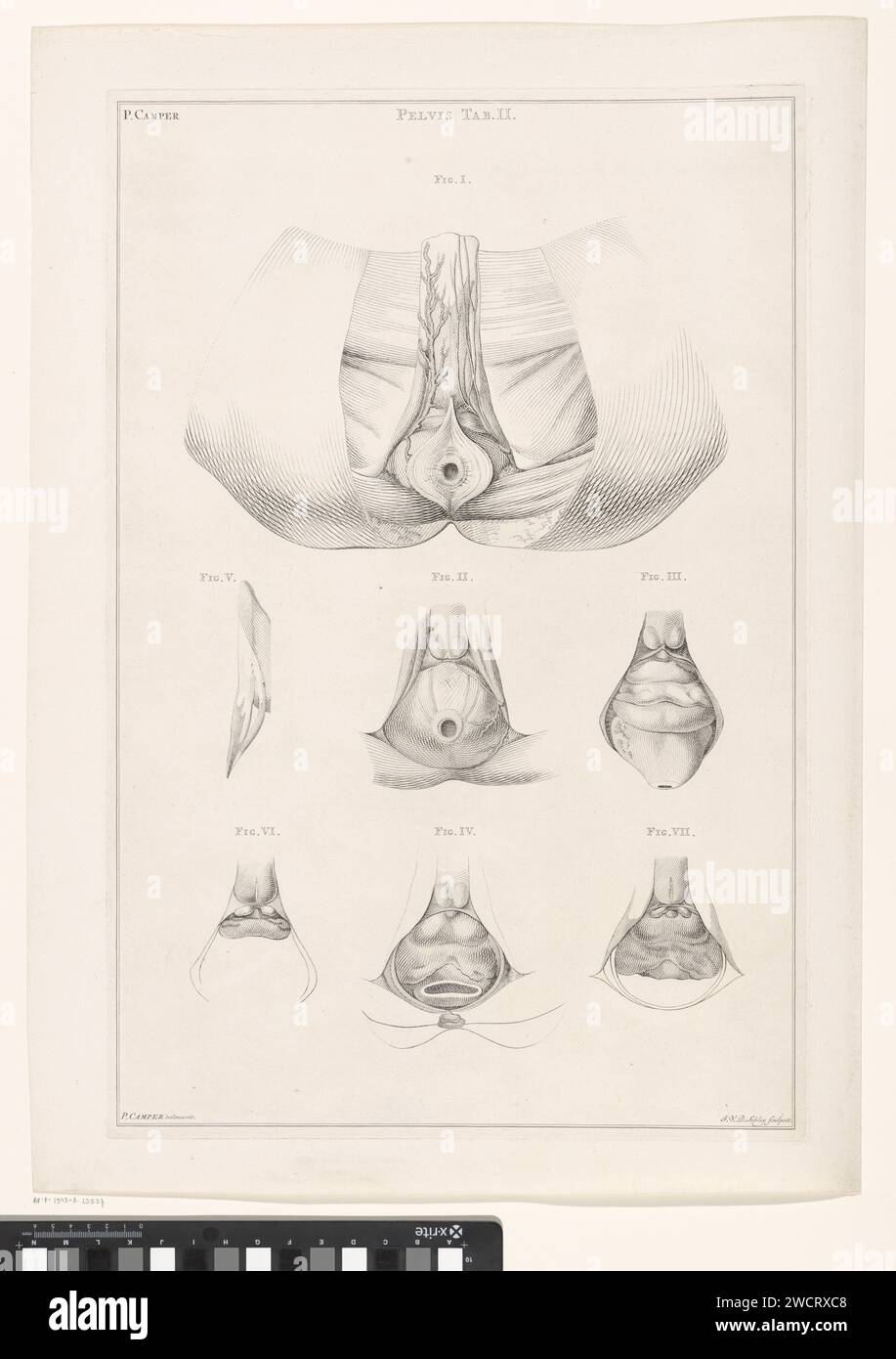 Anatomy van the Pelvis, Jacob van the Skley, nach Petrus Camper, 1762 Druckpapier zum Ätzen/Gravieren von Teilen des menschlichen Körpers (Skelett ausgenommen). Becken Stockfoto