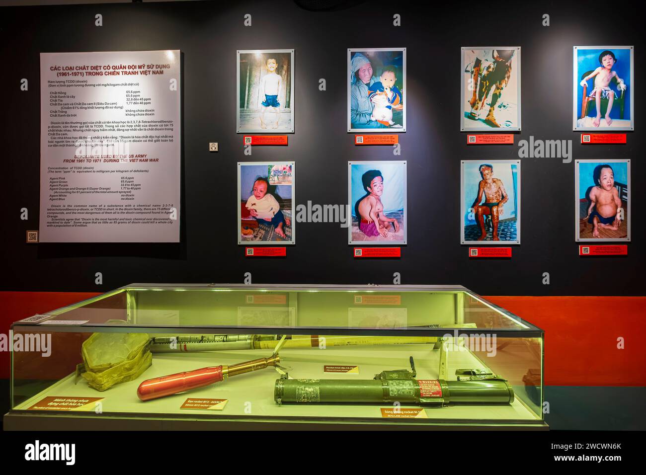 Vietnam, Ho-Chi-Minh-Stadt (Saigon), Bezirk 3, das war Remnants Museum, Bilder der Auswirkungen von Agent Orange Stockfoto