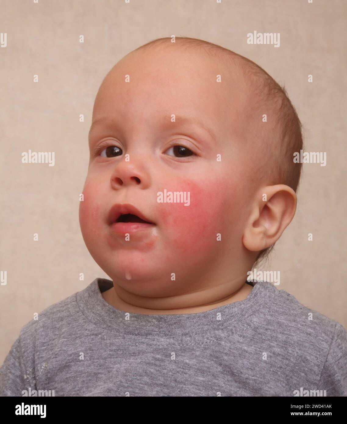 Kleiner Junge mit rosa Wangen Stockfoto