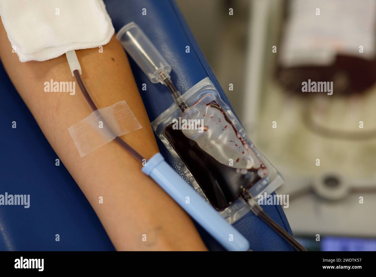Blutentnahme im Labor, Spende, Verband,. Hochwertige Fotos Stockfoto
