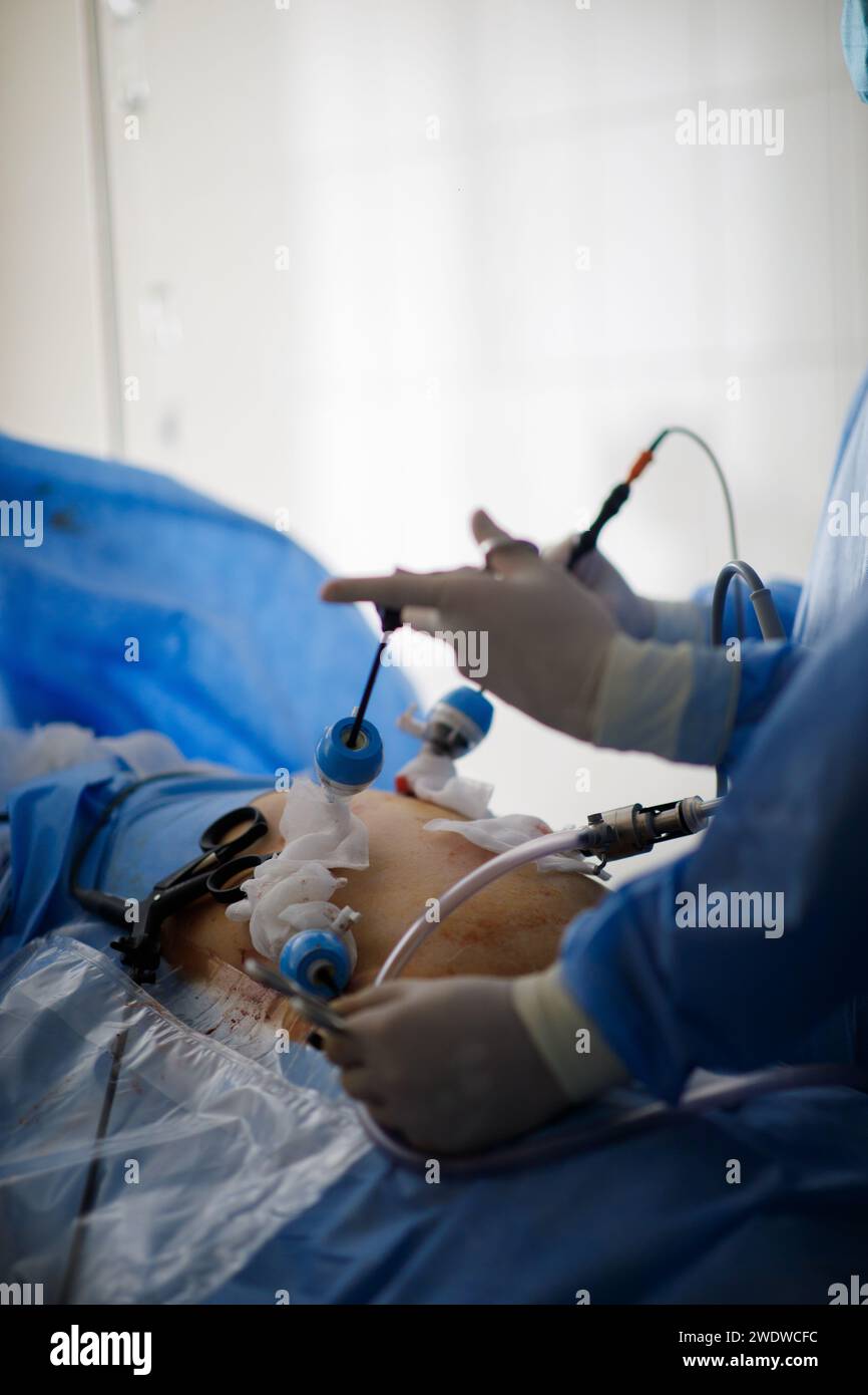 Laparoscopy Fotos und Bildmaterial in hoher Auflösung Alamy