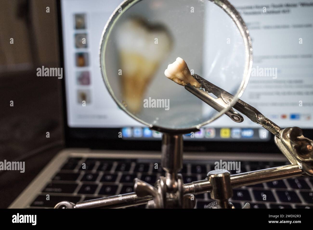 Seattle, USA. Januar 2024. Ein menschlicher Zahn, der von ebay auf einem Laptop mit der Liste gepuchelt wurde. Stockfoto