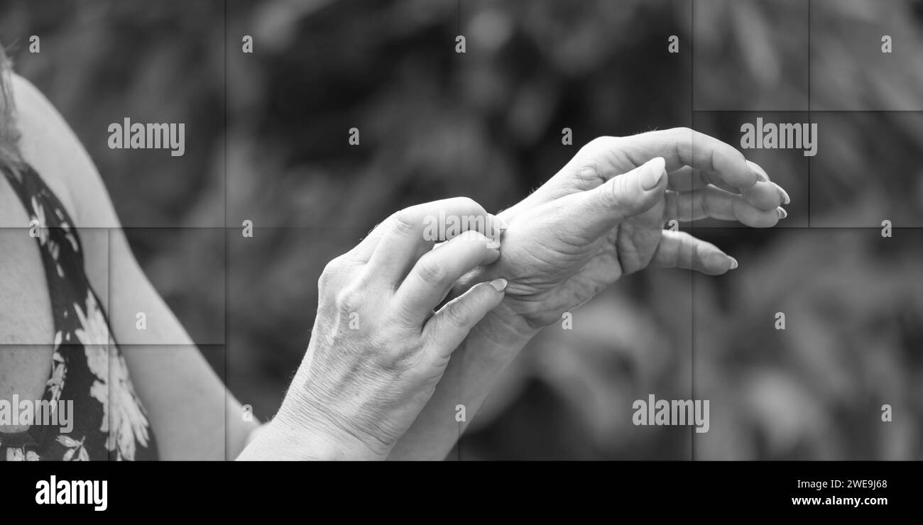 Eine Frau juckt und kratzt sich an der Hand, geometrisches Muster Stockfoto