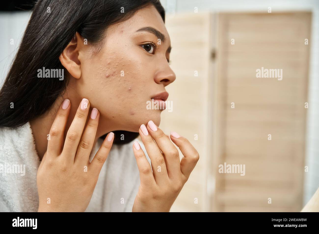 Junge asiatische Frau mit brünetten Haaren untersucht ihre Haut mit Akne im Spiegel, Hautproblem Stockfoto