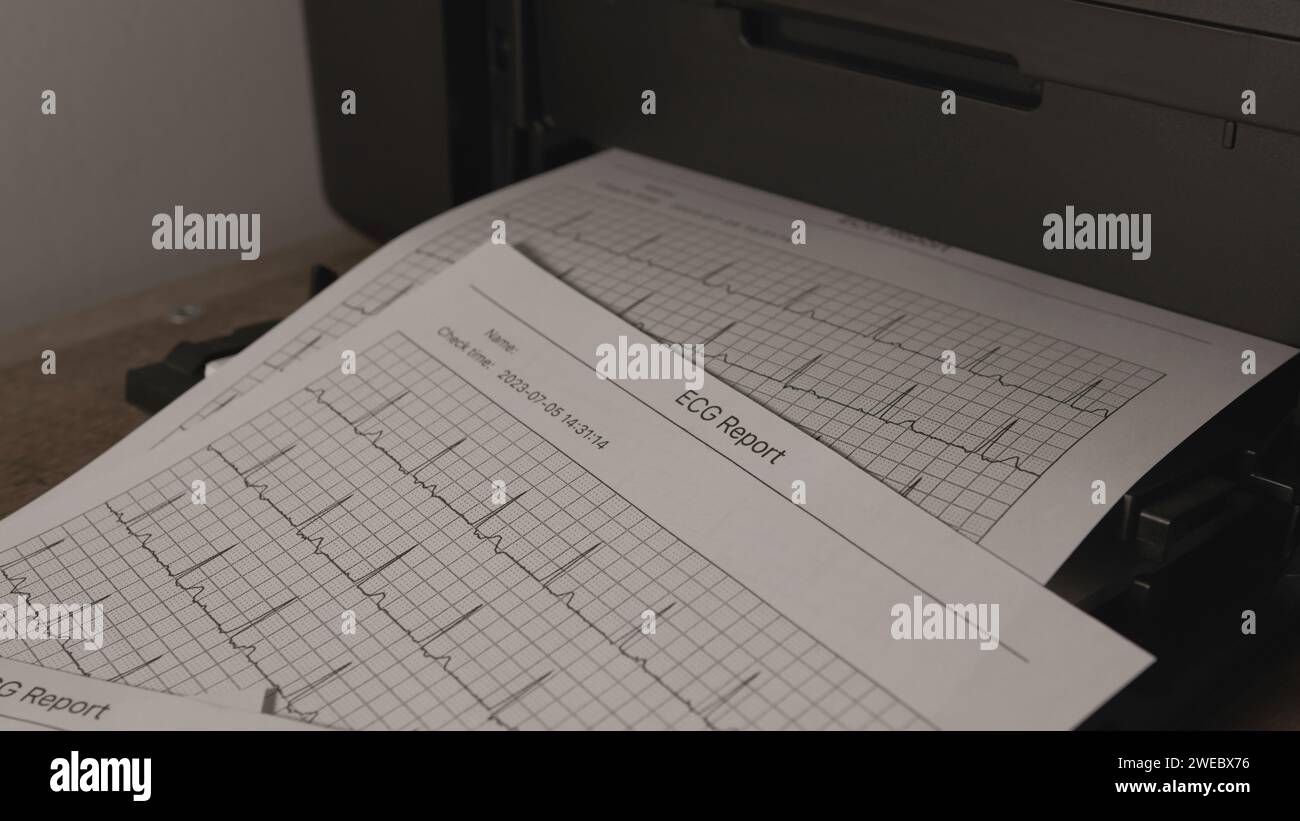Faxe oder Fotokopien von EKG-Berichten, die auf Papier gedruckt werden Stockfoto