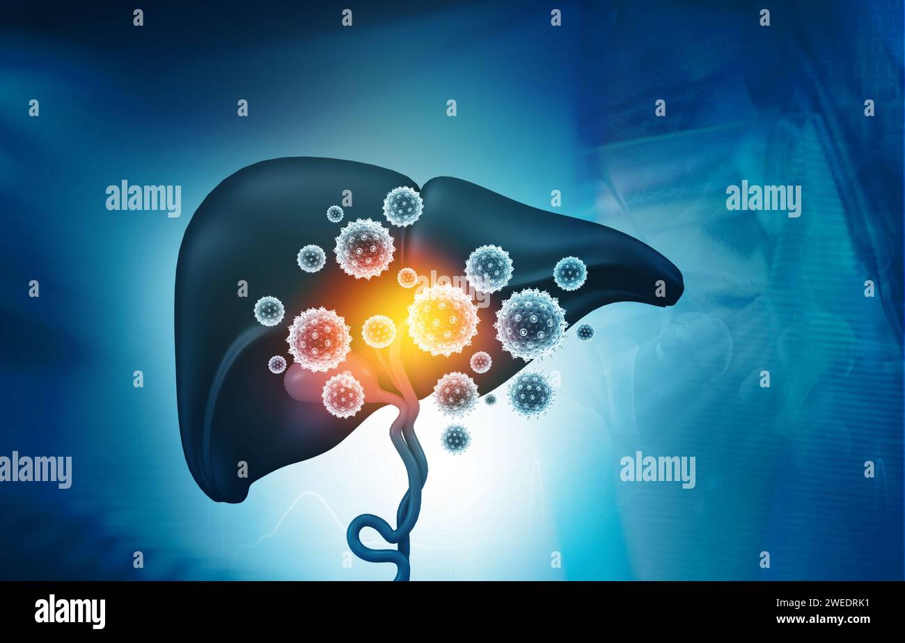 Virus befällt die menschliche Leber. 3D-Abbildung Stockfoto