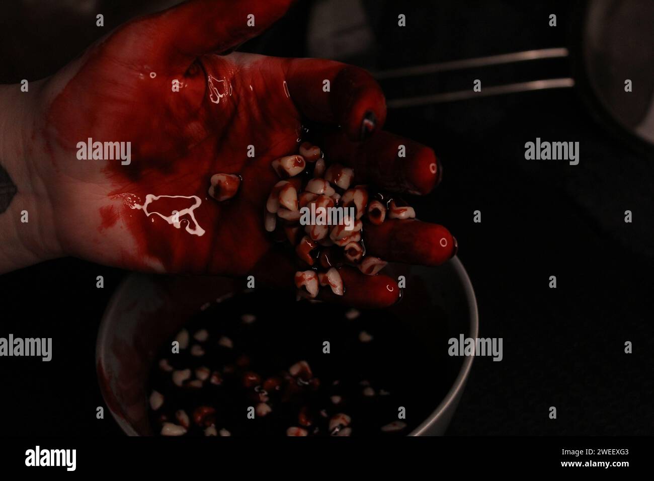 Blutige Zähne Stockfoto