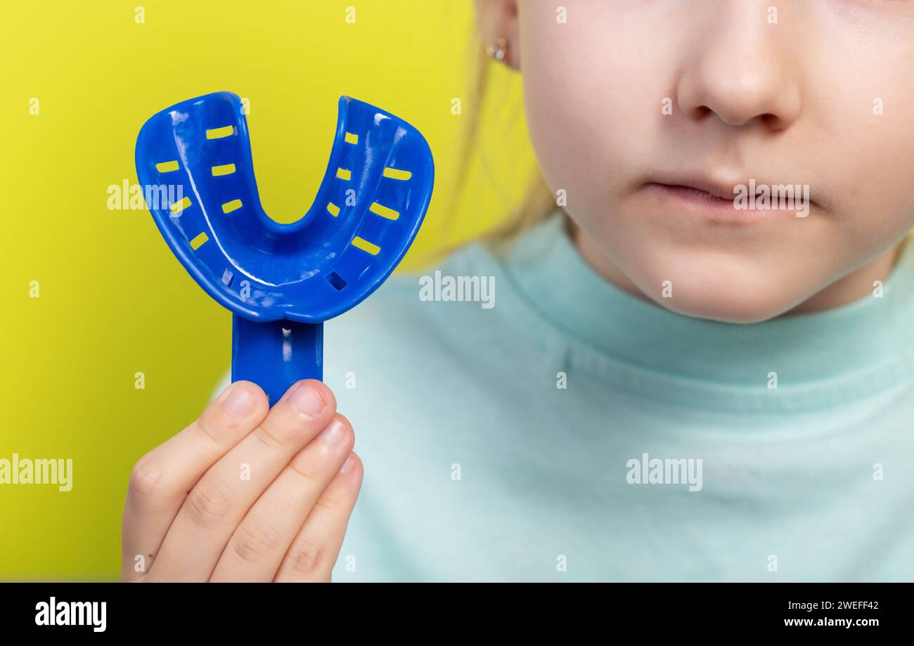 Ein blaues Dentalabdrucktablett vor dem Hintergrund des Mundes eines siebenjährigen Mädchens. Das Konzept der Abformung des Zahnkiefers für ch Stockfoto