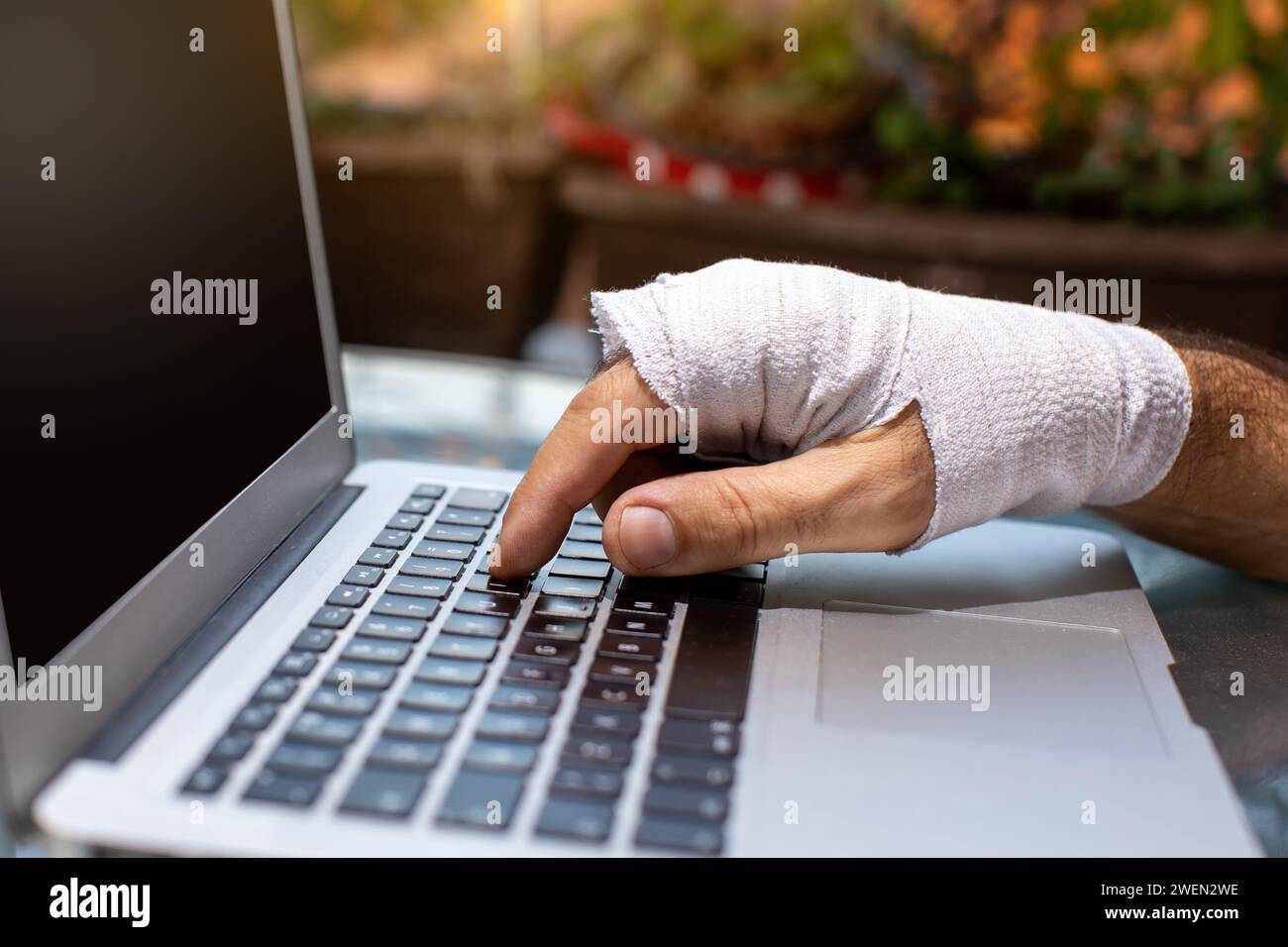 Person mit verletztem Handgelenk, die auf dem Laptop schreibt Stockfoto