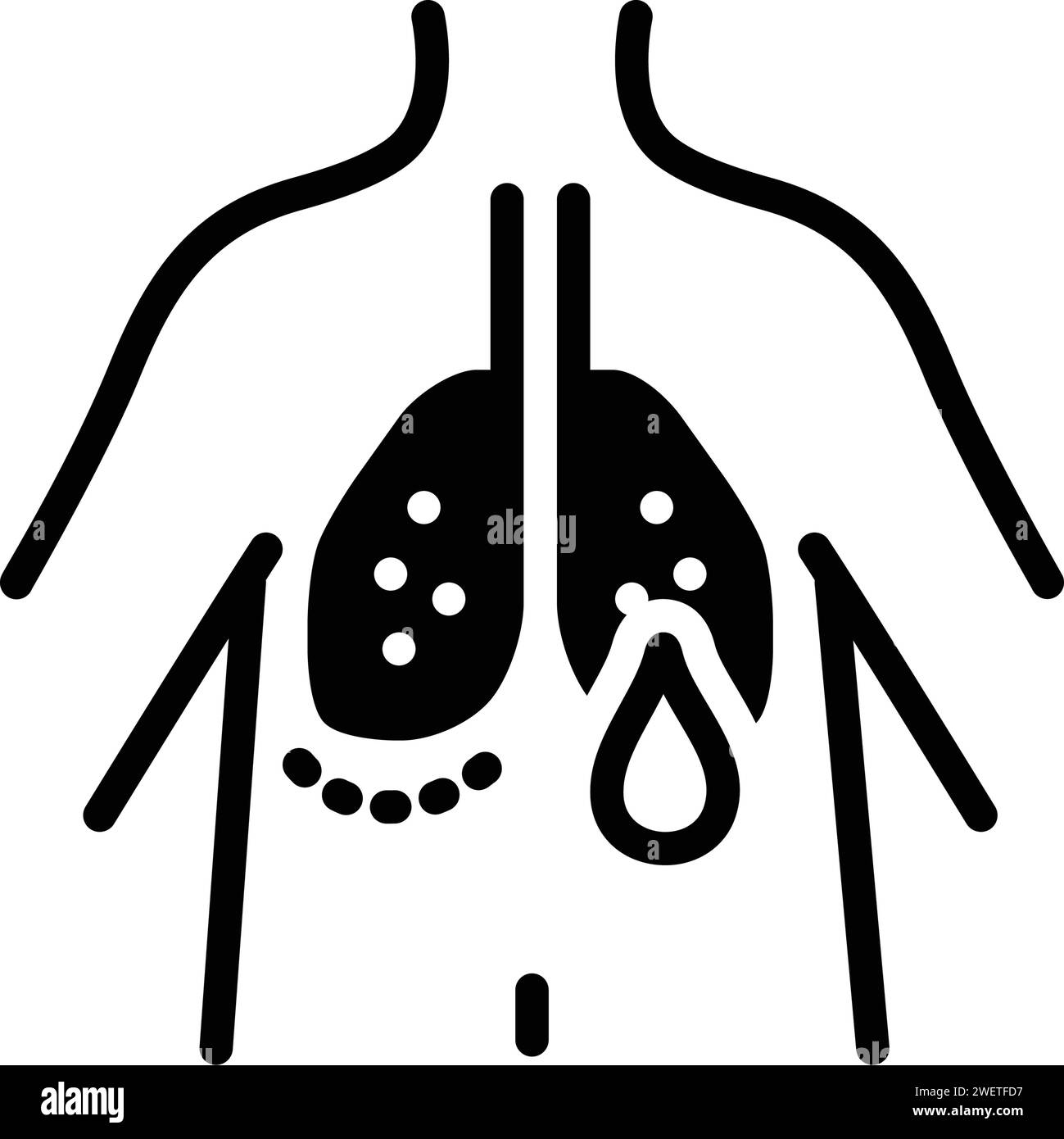 Hypoxämie -Fotos und -Bildmaterial in hoher Auflösung – Alamy