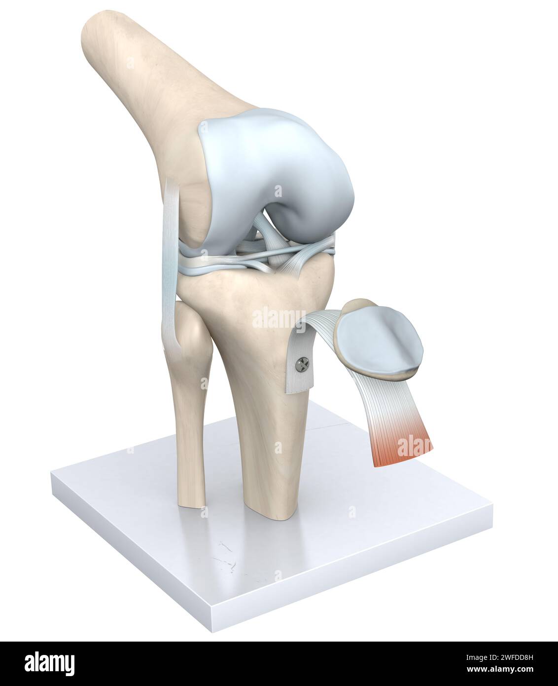 Das Kniegelenk, eine komplexe Scharnierstruktur, verbindet den Oberschenkelknochen (Femur) mit dem Schienbeinknochen (Tibia), das durch Knorpel gepolstert wird, wodurch Beugung und Dehnung ermöglicht werden Stockfoto