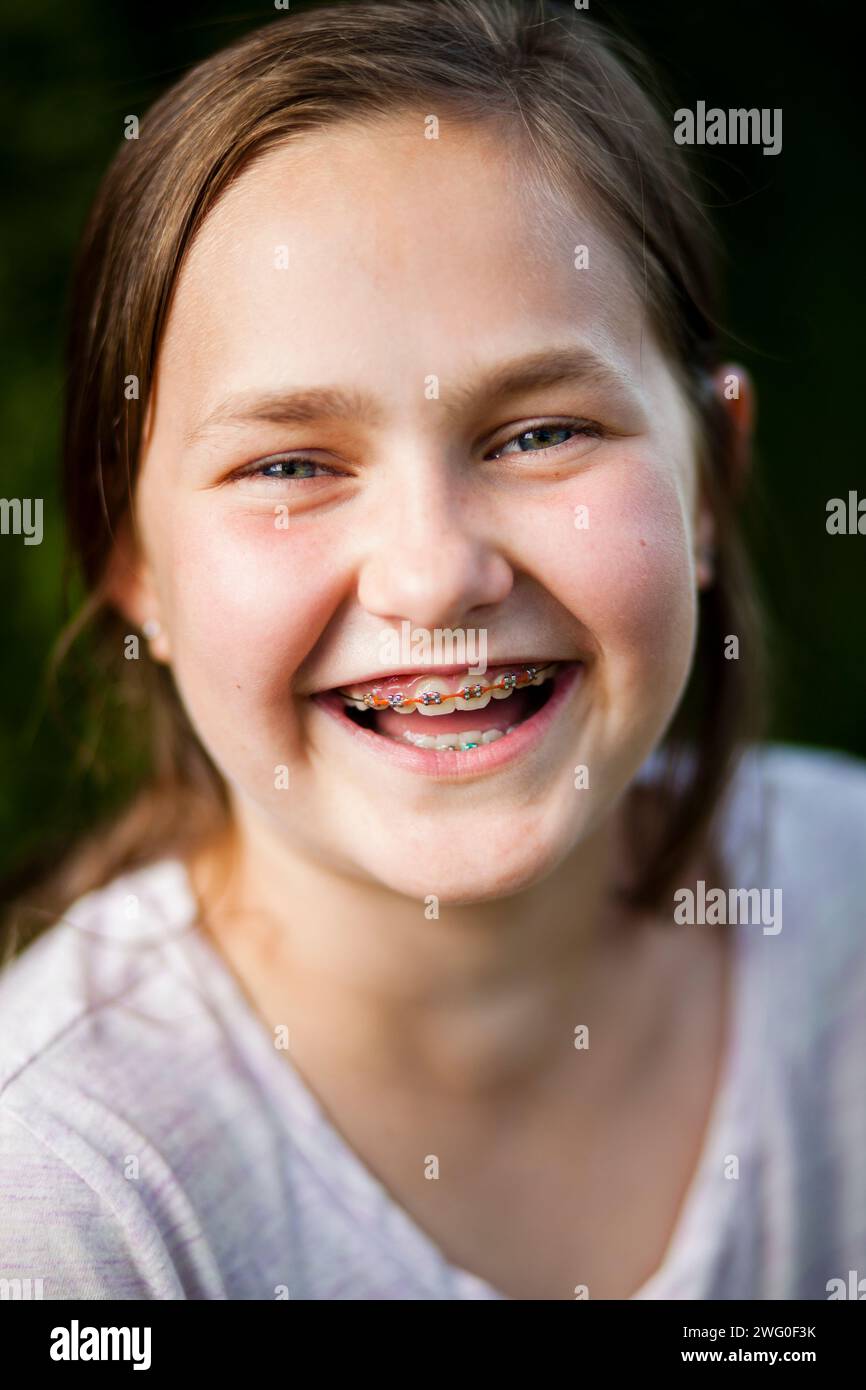Ein Porträt eines 12-jährigen Mädchens, das lacht, während sie ihre Zahnspange zeigt. Stockfoto