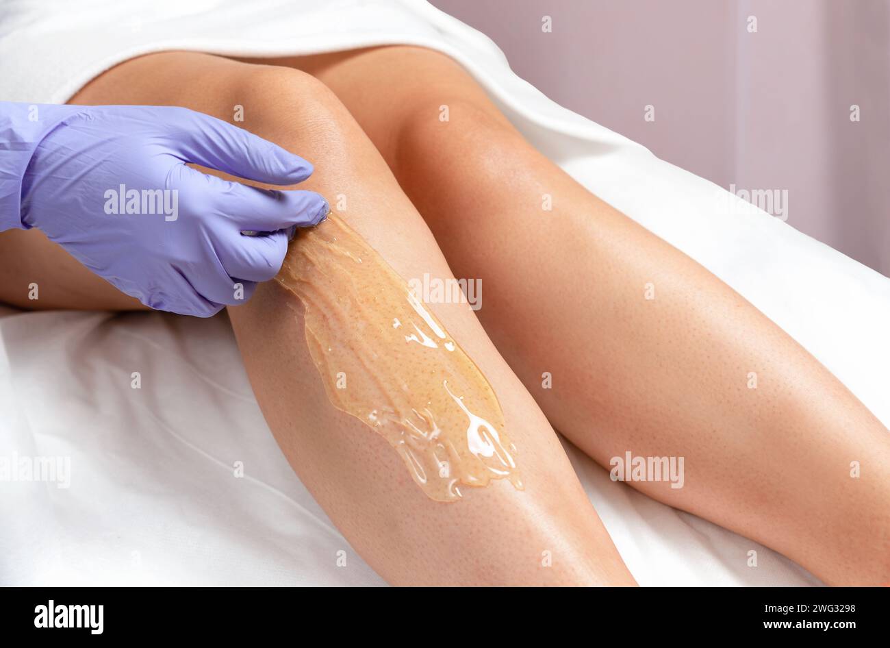 Fusszuckerverfahren in einem Schönheitssalon. Ein Meister mit Handschuhen trägt Zuckerpaste auf das Bein einer Frau zum Enthaaren auf. Stockfoto