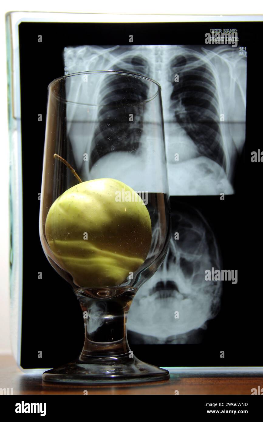 Medizinische Symbole. Wissensapfel im Glas vor dem röntgenographischen Bild der Cortex-Analyse Stockfoto