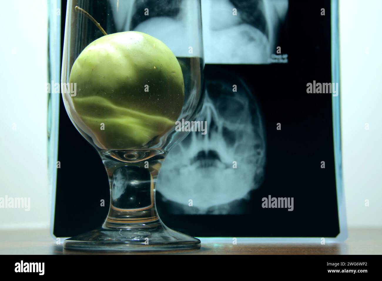 Gesundheit gegen Krankheiten. Apfel im Klarglas über Röntgenbild der Röntgenanalyse von Hirnerkrankungen Stockfoto