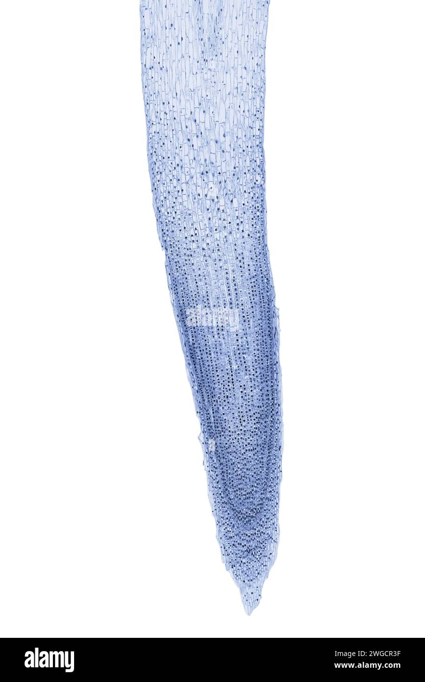 Zwiebelwurzelspitze, Allium cepa, zeigt alle Stadien der Mitose, Längsschnitt, 20-facher Lichtmikrograph. Schneiden Sie die Wurzelspitze einer Zwiebelspitze längs. Stockfoto