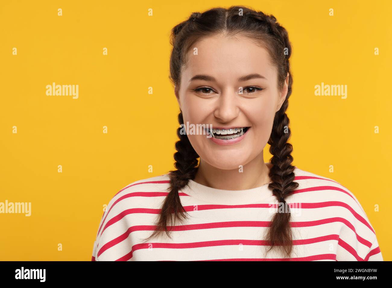 Lächelnde Frau mit Zahnspangen und kieferorthopädischen Gummibändern auf orangem Hintergrund. Leerzeichen für Text Stockfoto