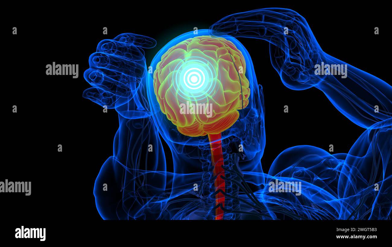 Gefühlskopfschmerzanatomie für medizinische Konzeptbildgebung Stockfoto