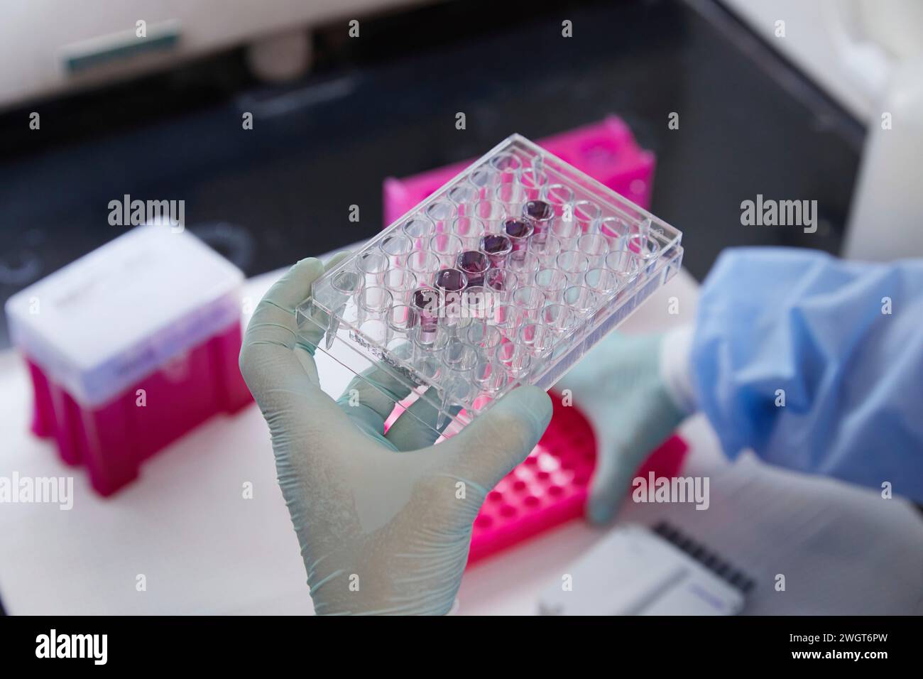 Werkzeuge und Behälter in einem medizinischen Labor, Arbeiten mit Pipette und Proben Stockfoto