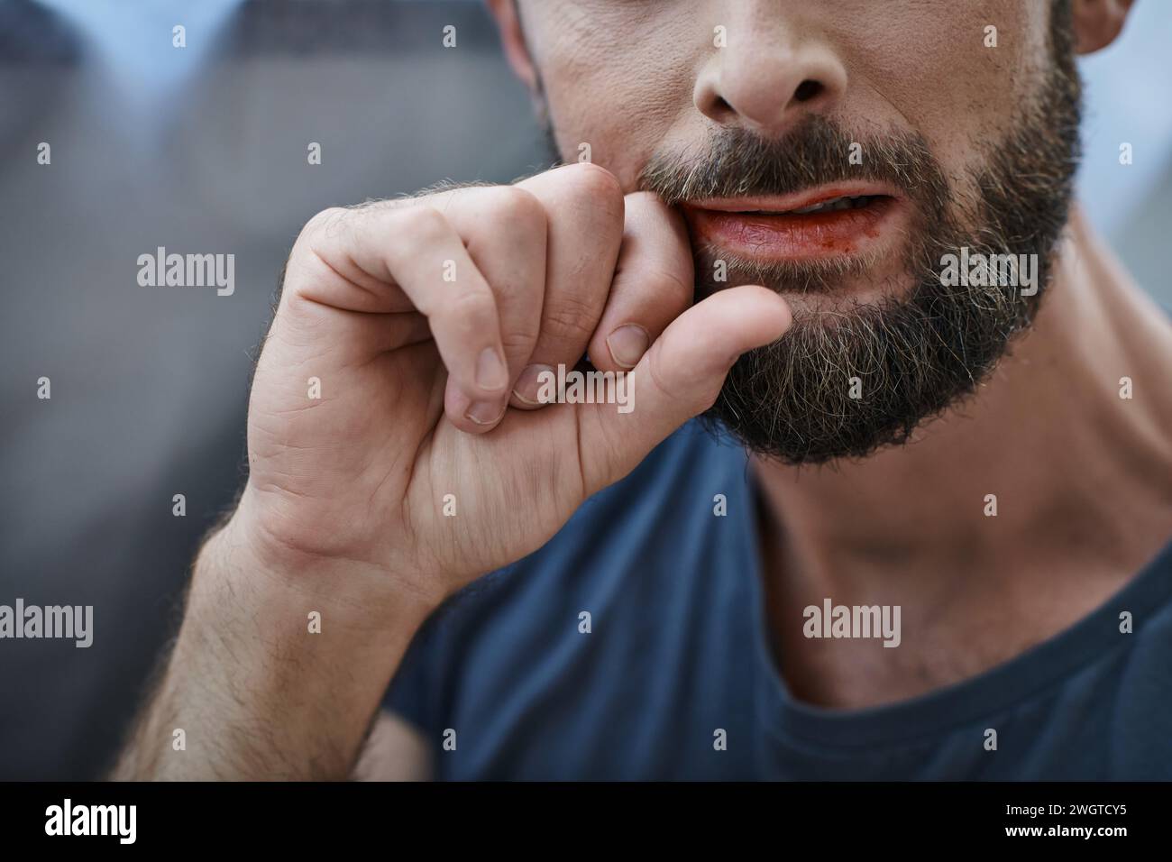 Zugeschnittene Ansicht eines ängstlichen Mannes mit Bart, der während einer depressiven Episode auf die Lippen beißt Stockfoto