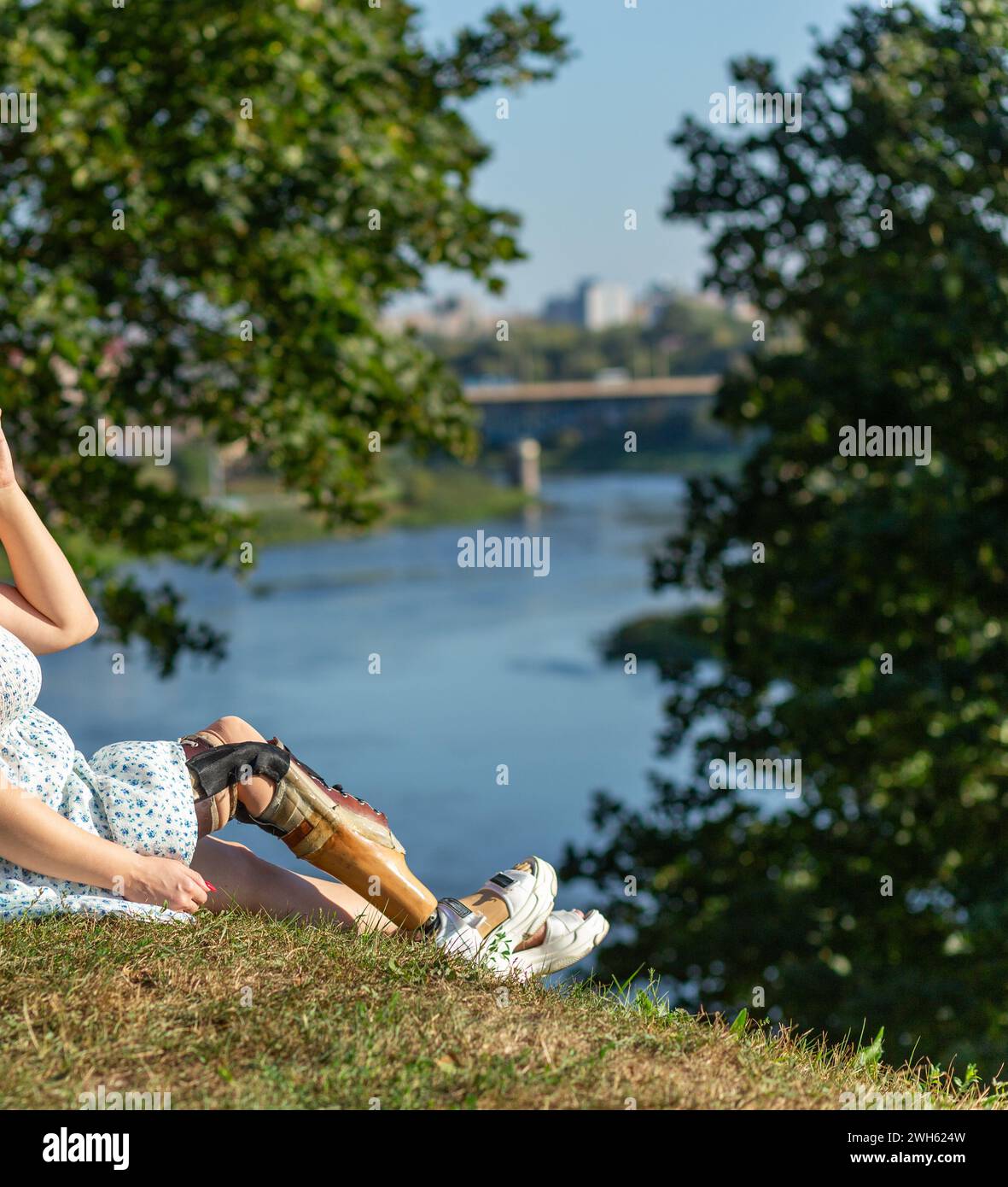 Schöne junge Frau Beinamputierte in einem Kleid, die im Park in der Nähe des Flusses an sonnigen Tagen spaziert. Das Leben geht weiter, egal was passiert. Stockfoto