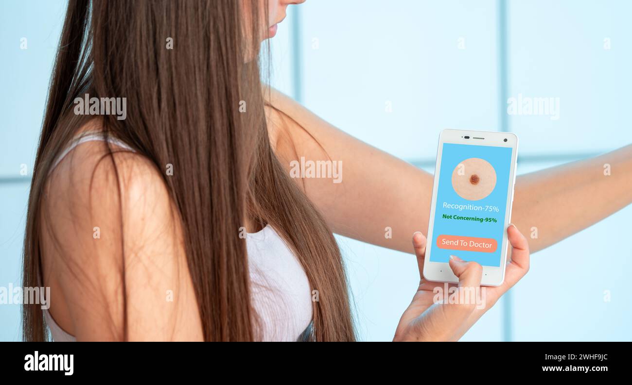 Frau, die das Hautkrebsrisiko mit dem Smartphone einschätzt Stockfoto