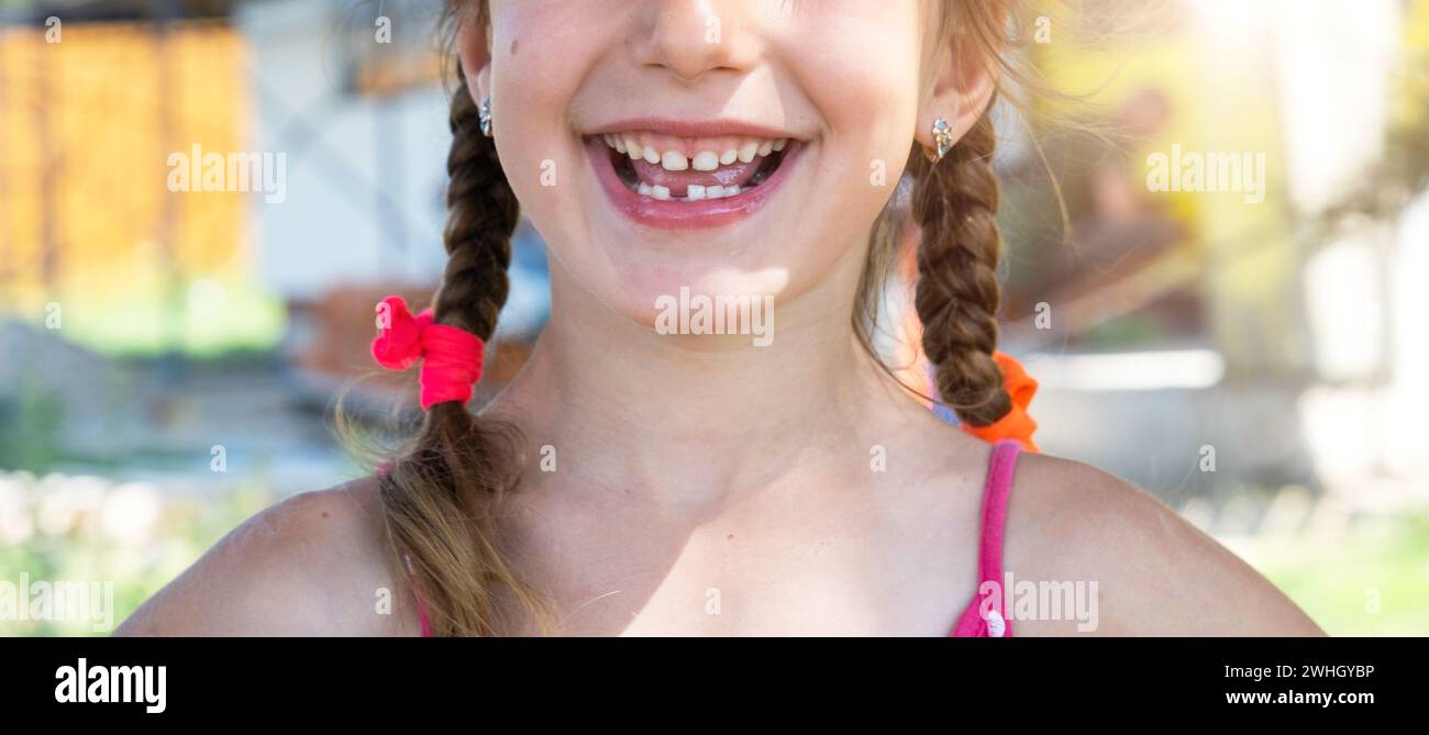 Zahnloses glückliches Lächeln eines Mädchens mit einem gefallenen Milchzahn aus der Nahaufnahme. Zahnwechsel zu Backenzähnen im Kindesalter Stockfoto