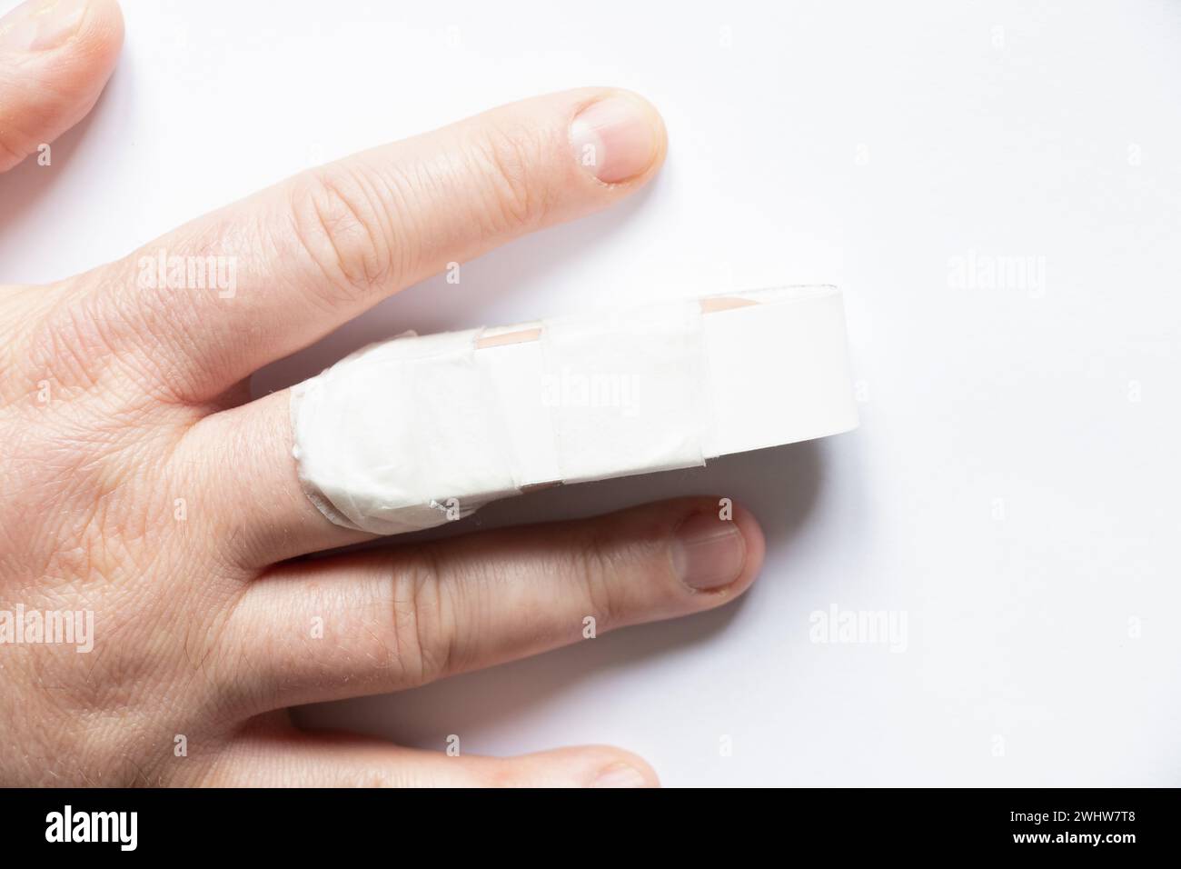 Die Hand eines Mannes mit einem gebrochenen Finger und einer Schiene auf einem gebrochenen Finger auf einem weißen Hintergrund, ein gebrochener Finger, Verletzung, Unfall, ein Mann brach sich die Flosse Stockfoto