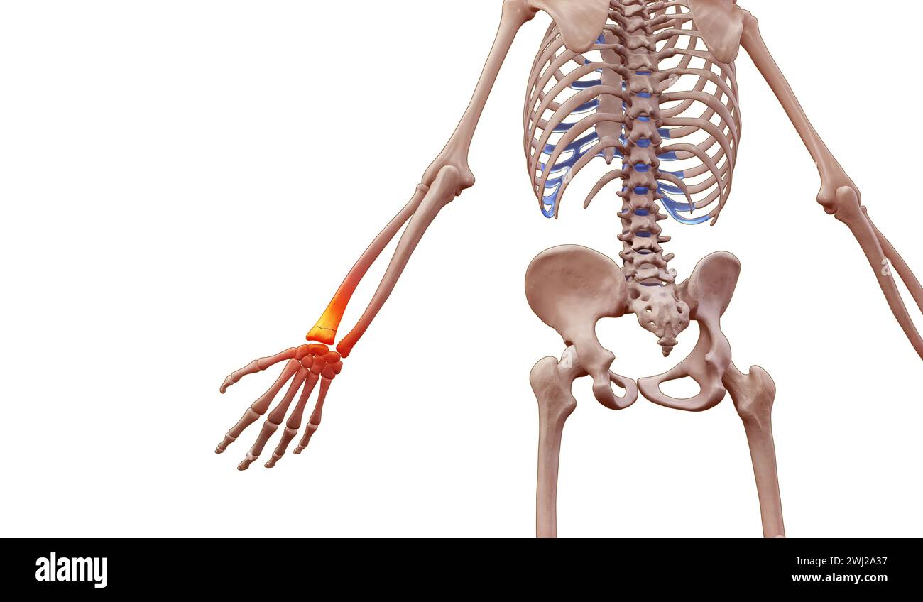 3D-Darstellung eines menschlichen Skeletts mit Handgelenkschmerzen Stockfoto