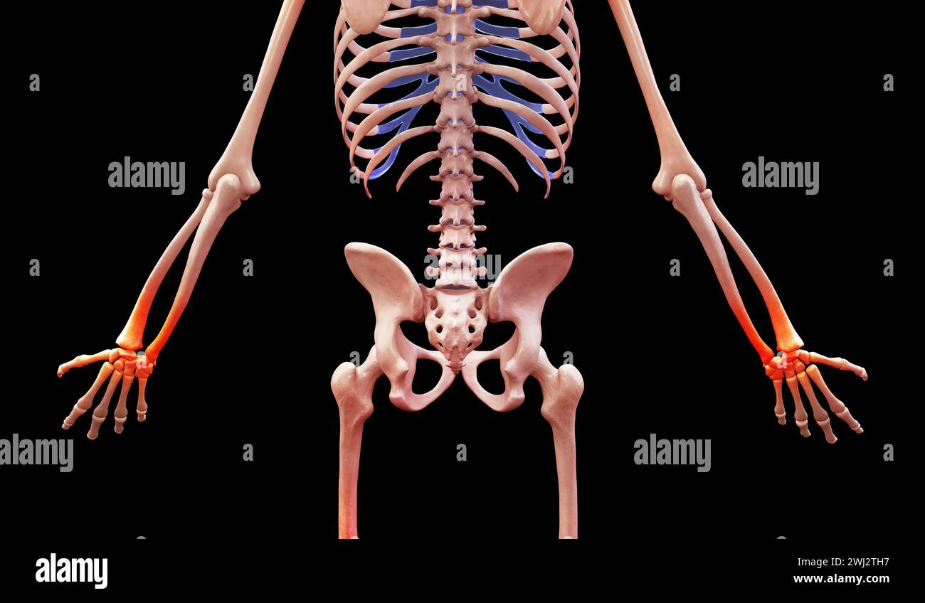 3D-Darstellung eines menschlichen Skeletts mit Handgelenkschmerzen Stockfoto