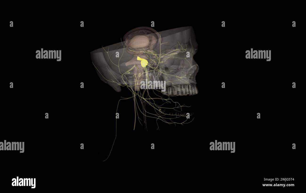 Das Ganglion trigeminus befindet sich seitlich zur Sinus cavernosus, in einer Depression des Schläfenbeins. Stockfoto