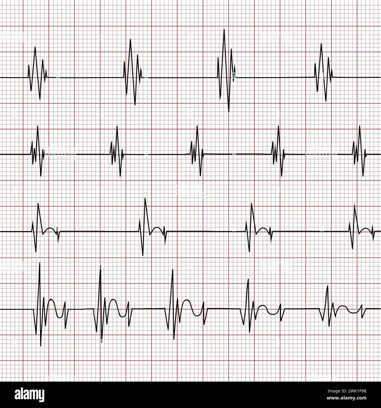 Mehrere EKG-Diagramme (Elektrokardiogramm) auf einem Gitterhintergrund. Verschiedene Herzrhythmen und Herzzustandsanalyse. Monitoring der Herzgesundheit. Vektor Stock Vektor