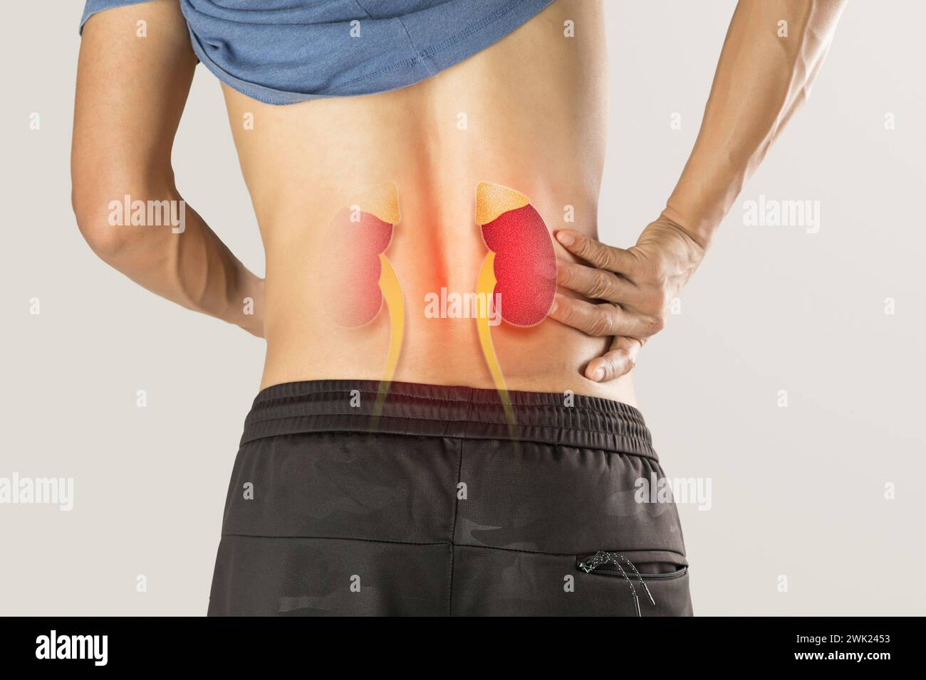 Männer mit Nierenversagen auf grauem Hintergrund. Stockfoto