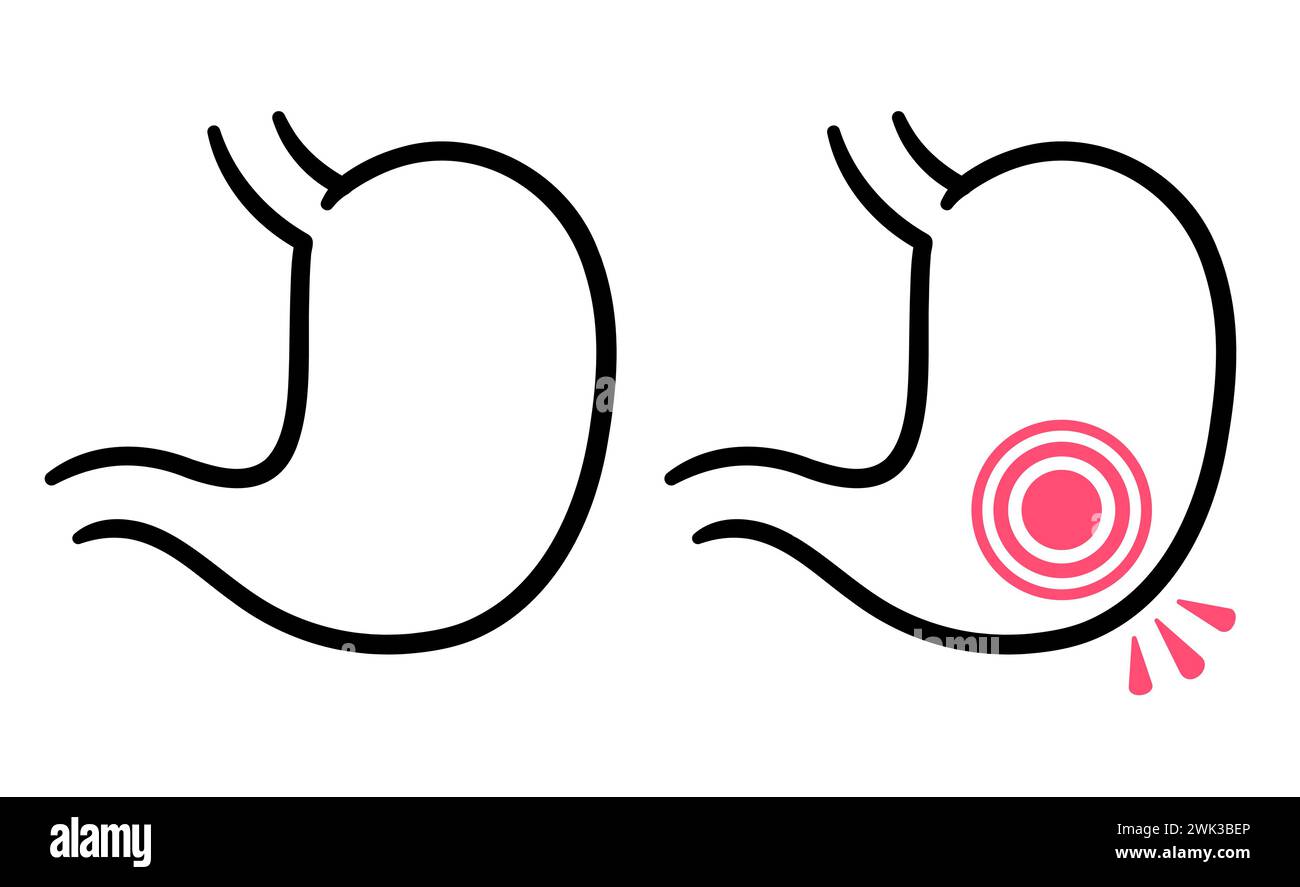 Handgezeichnetes Symbol für Magenschmerzen. Menschliche Magenzeichnung mit entzündetem roten Kreis. Vektorabbildung. Stock Vektor