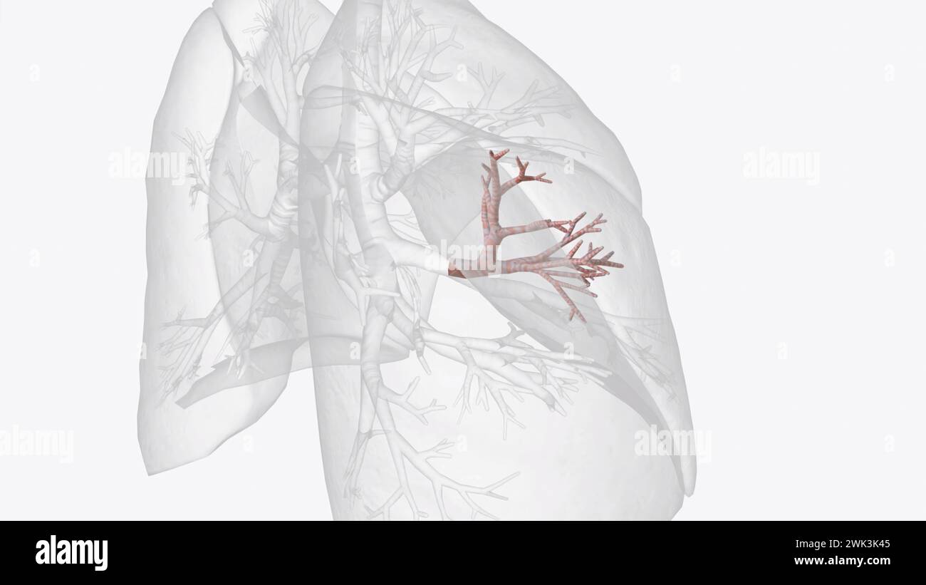 Das laterale Segment wird am besten auf der Rippenoberfläche der Lunge dargestellt, während sich die oberflächliche Grenze des medialen Segments um den Anter schlängelt Stockfoto