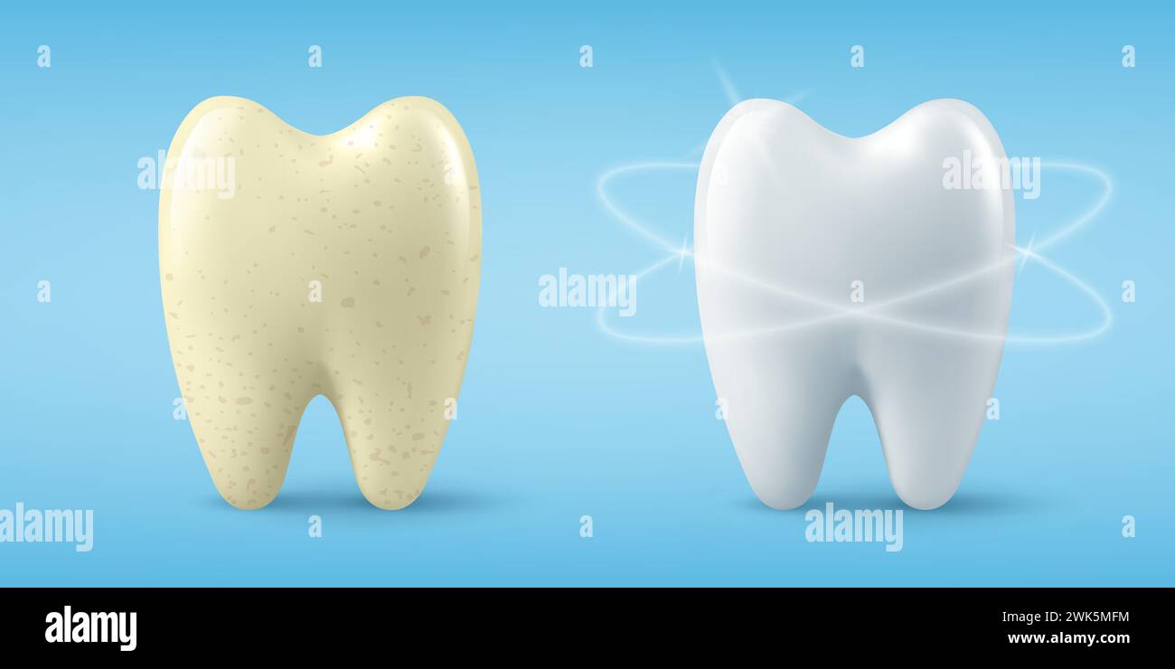 Vektor-Banner mit realistischem schmutzigem und sauberem Zahn. Reinigungskonzept, Vor, Nach Hygienischer Zahnreinigung. Zahnheilkunde Design für Medizin, Zahnpasta Stock Vektor
