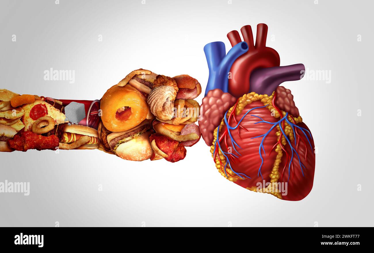Ungesunde Ernährung Herzinfarkt als Junk Food oder und hoher Cholesterin-Fastfood, die hart die menschliche Herz-Kreislauf-Organ-Krankheit wie Atherosklerose treffen Stockfoto